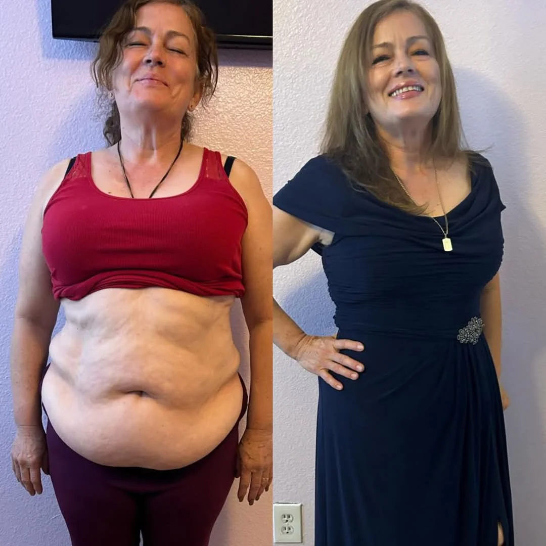 Testimonio real de transformación - Antes y después 20