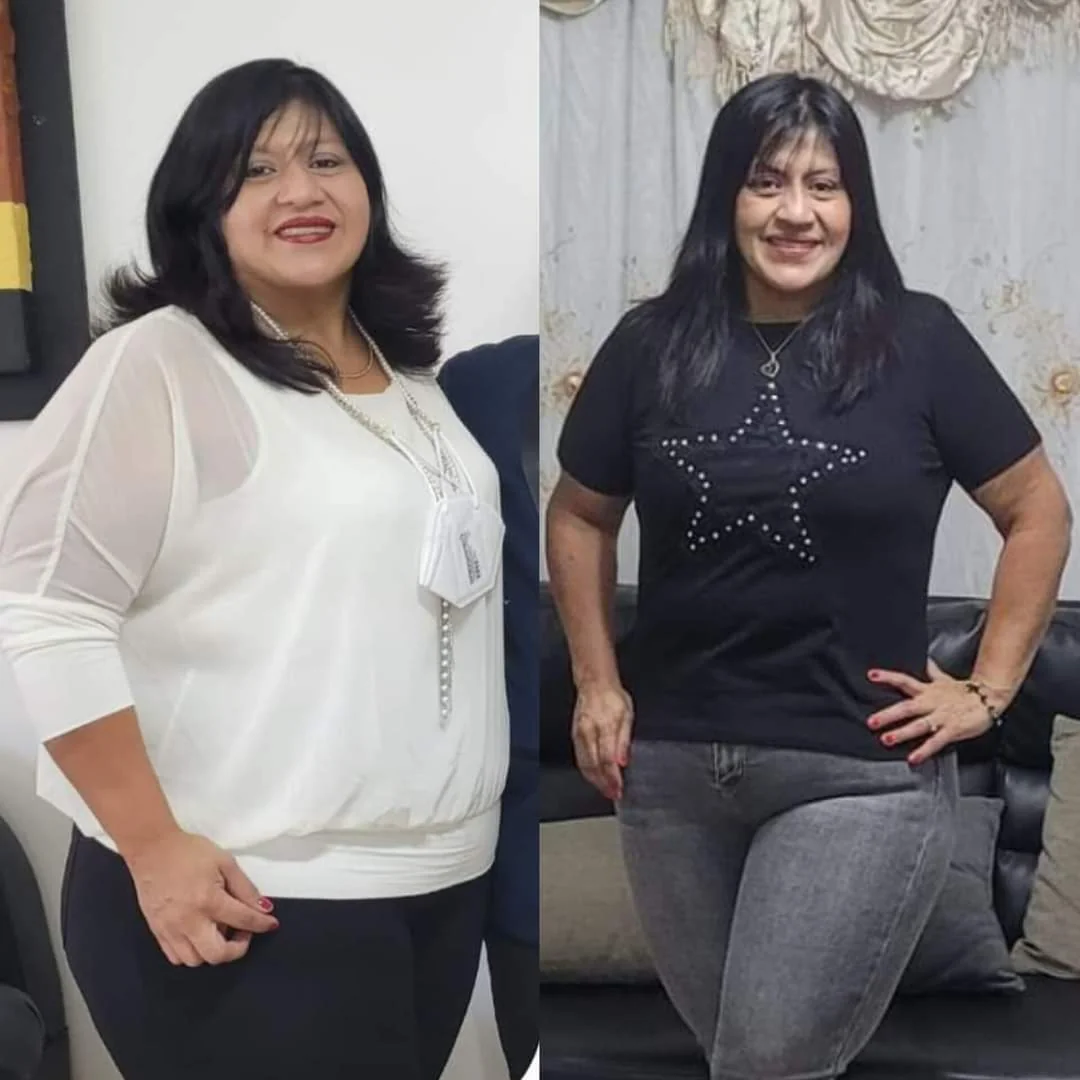 Testimonio real de transformación - Antes y después 4