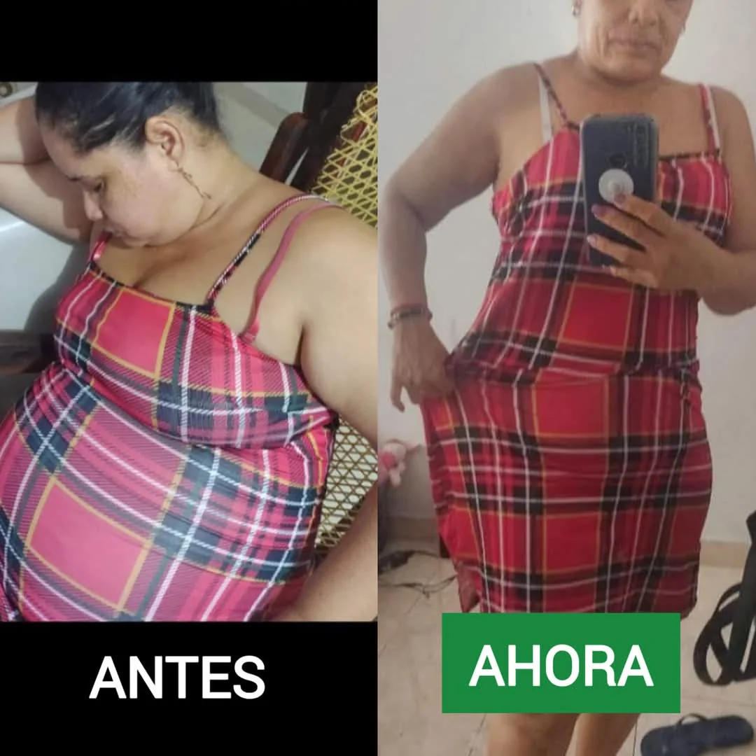 Testimonio real de transformación - Antes y después 1