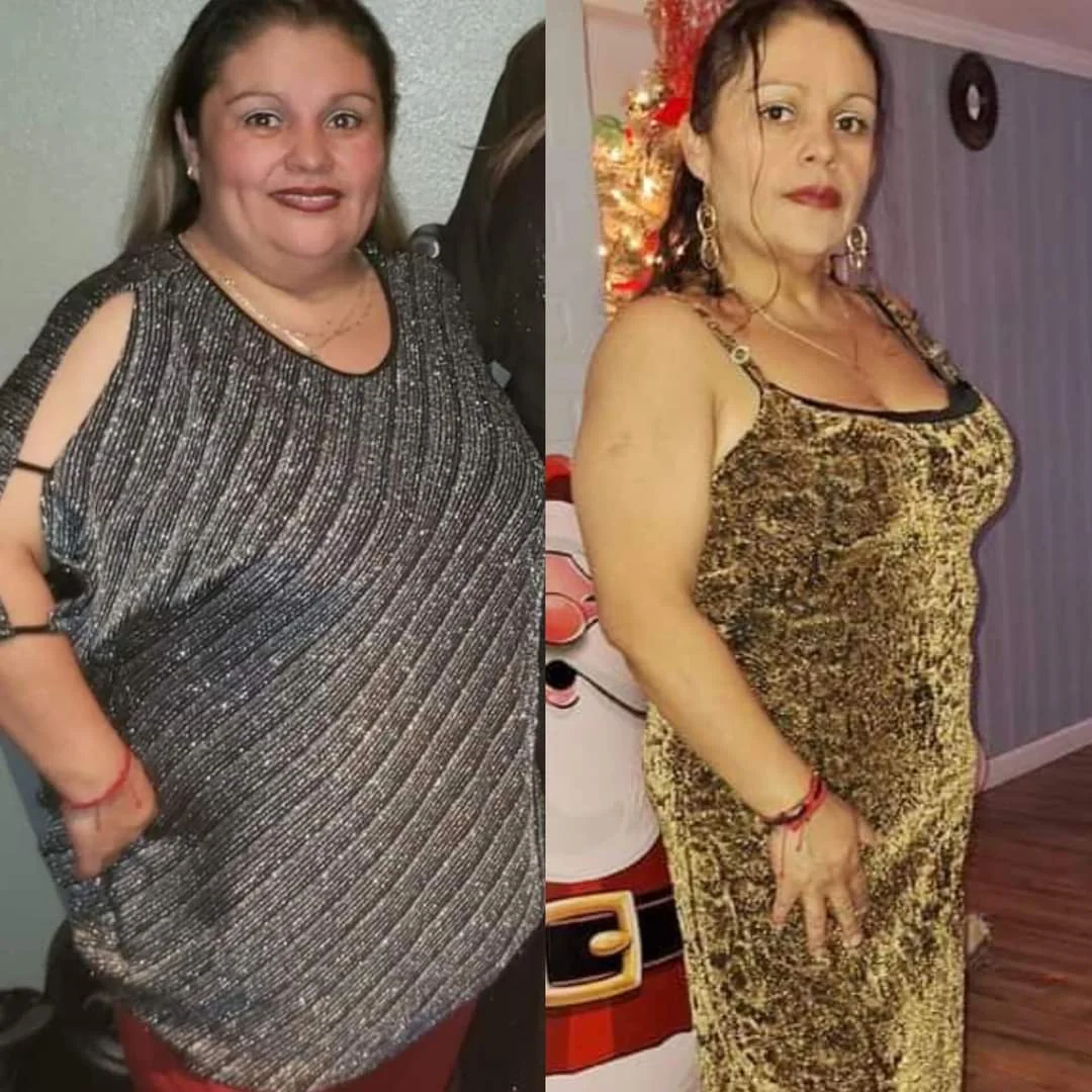 Testimonio real de transformación - Antes y después 12