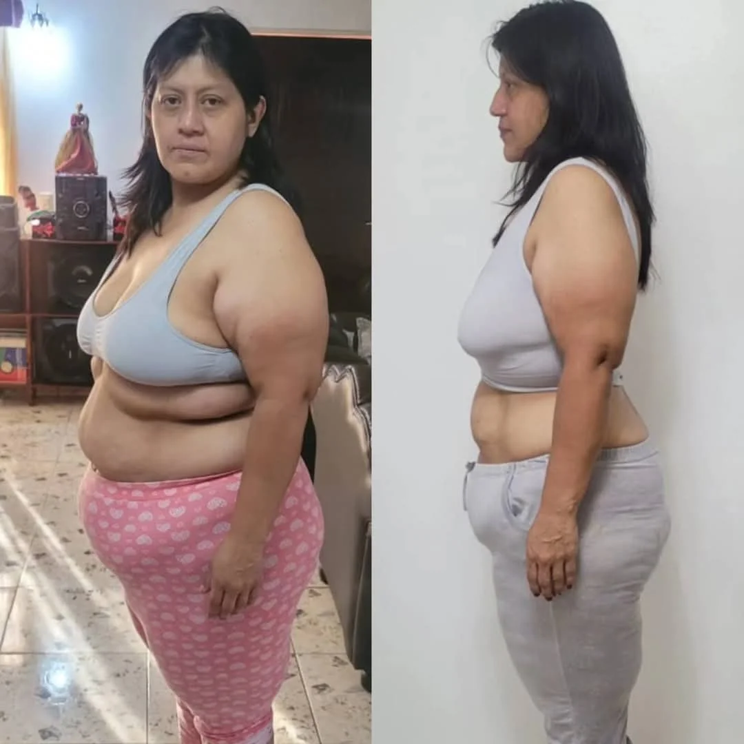 Testimonio real de transformación - Antes y después 15