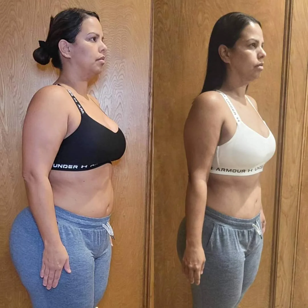 Testimonio real de transformación - Antes y después 16